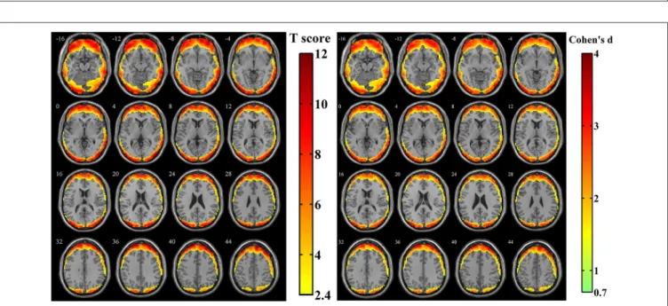 FIGURE 4 | The t-score map and Cohen’s d map obtained from 44 z-standardized ratio maps (SD maps in Simulation 1 divided by SD maps in human data)
