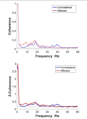 FigUre 3 | Top: non-standardized coherence; bottom: z-coherence. 