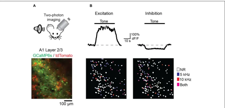 FIGURE 2 | Imaging A1 sensory representations in awake mice. (A) (Top) Recording schematic