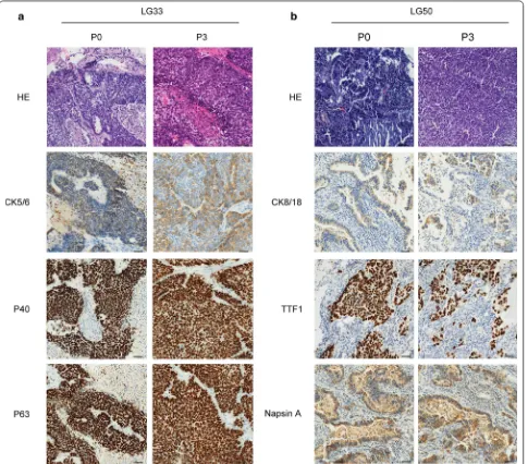 Fig. 2 Histologic and immunohistochemistric features of patients’ lung cancers and their corresponding xenograft
