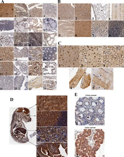 Figure 1: Expression and localization of endogenous MTA1 in tissues detected using immunohistochemistry