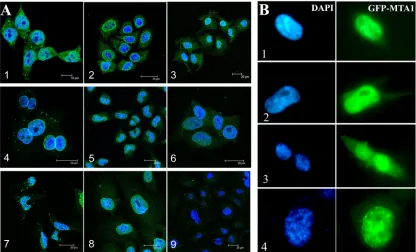 Figure 2: Subcellular localization of MTA1 in cell lines detected through IF (A) and GFP-tag tracing (B)