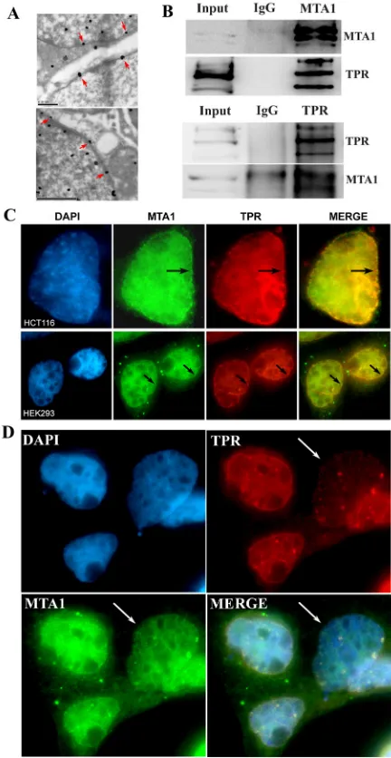 Figure 6: Localization of MTA1 on microtubules in the cytoplasm. NCI-H446 cells and colon tissues were immuno-stained with specific antibodies against MTA1 and α-tubulin, followed by detection using a laser scanning confocal microscope
