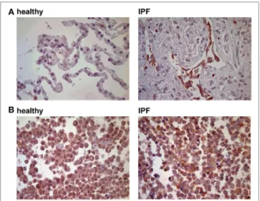 FigUre 2 | P2Y 6 R expression in bleomycin-induced pulmonary fibrosis. 
