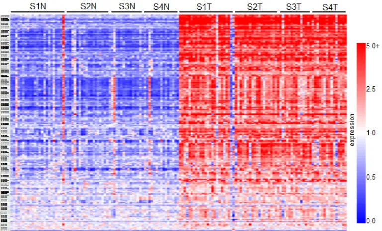 Figure 1: Results of a high-throughput gene-array screen evaluating gene transcript expression between ccRCC and normal matched patient tissue samples