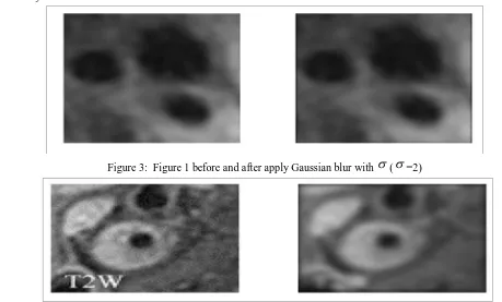 Figure 3:  Figure 1 before and after apply Gaussian blur with  ( =2) 