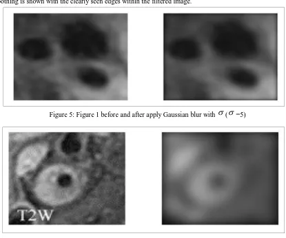 Figure 3 and figure 4 compare the different image qualities before and after applying Gaussian smoothing filter