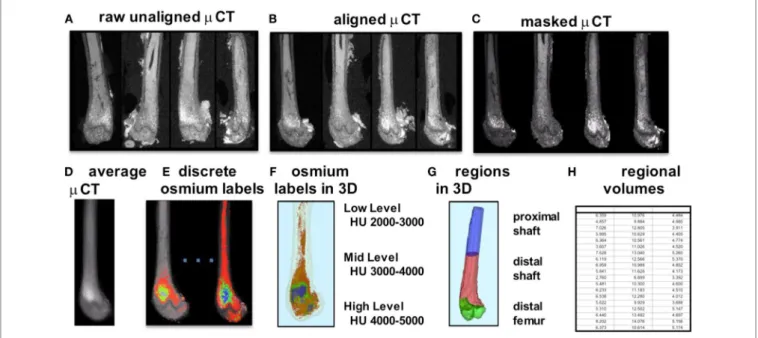 FigURe 1 | Overview of method for visualization and quantification of marrow adipose tissue (MAT)