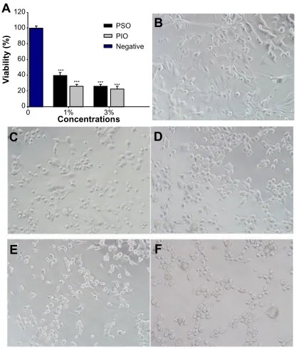 Figure 3 High-performance liquid chromatograms of saponified PSO (A), PIO (B), commercial polysorbate 80-1 (C), and commercial polysorbate 80-2 (D).Abbreviations: PsO, polyoxyethylene sorbitol oleate; PIO, polyoxyethylene isosorbide.
