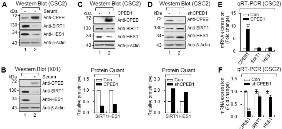 Figure 5: CPEB1 regulates translation of HES1 and SIRT1 mRNAs. (A and B) WB of CPEB1, SIRT1 and HES1 in CSC2 (A) and X01 (B) with serum or without serum