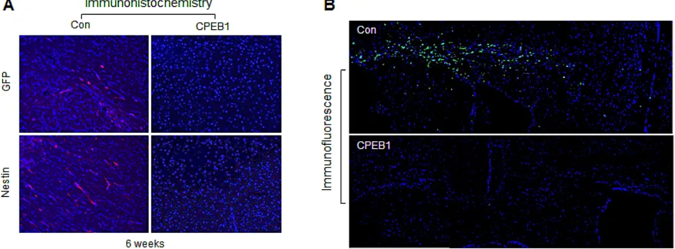 Figure 6: CPEB1 overexpression inhibits tumorigenicity of CSC2 model. (A) CSC2 infected with CPEB1-GFP (right) or control (left) lentiviral construct were injected at intracranial Balb/c-nu mice