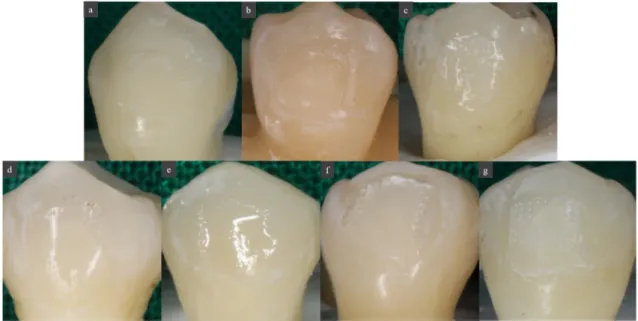 Figure 4. Images of tooth surface after shear bond strength test. (a) Control; (b) BAG 0.2%; (c) BAG  1.0%; (d) BAG@Ag1 0.2%; (e) BAG@Ag1 1.0%; (f) BAG@Zn5 0.2%; (g) BAG@Zn5 1.0%