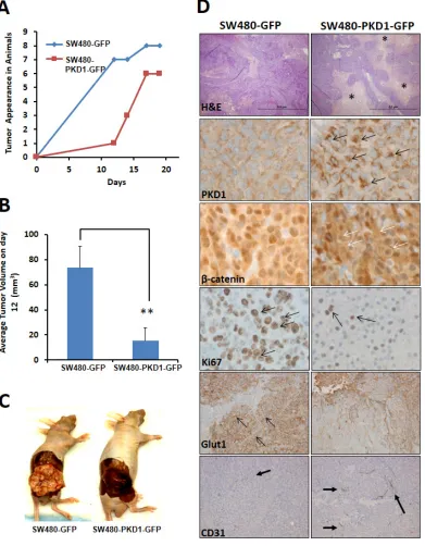 Figure 6: PKD1 overexpression delays tumor growth in xenograft mouse model. (A) Tumor appearance