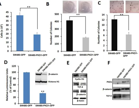 Figure 2: PKD1 overexpression decreases tumorigenic phenotypes by inhibiting the nuclear transcriptional activity of β-catenin in SW480 colon cancer cells