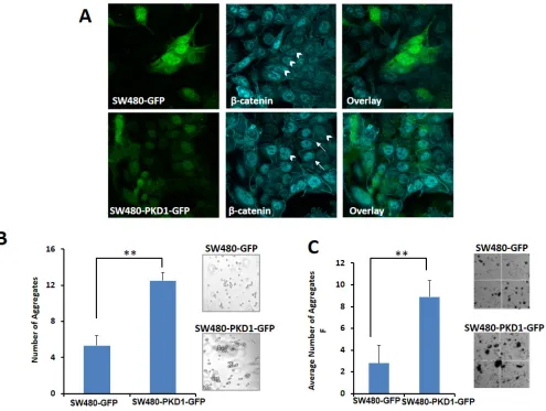 Figure 4: PKD1 overexpression enhances membrane localization of β-catenin and decreases nuclear β-catenin transcription activity