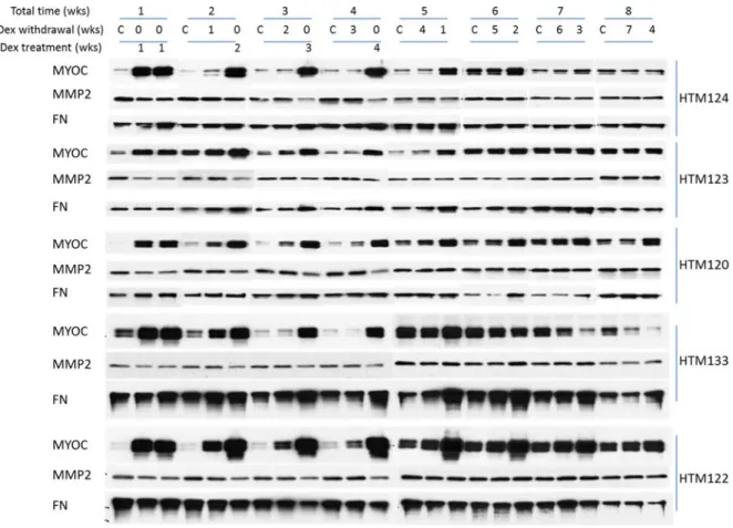 Figure 1. Dexamethasone (Dex)-induced changes in the secretion of MYOC, MMP2 and FN from  five different HTM cell strains