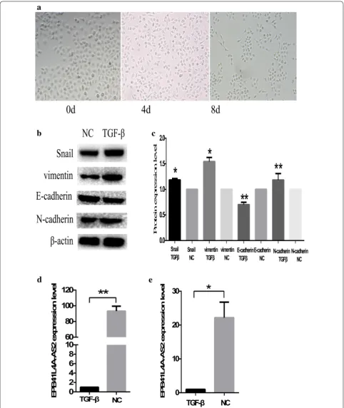 Fig. 5 EPB41L4A‑AS2 is downregulated in the CNE1‑EMT model. a TGF‑β‑induced cell scattering and morphologic changes in CNE‑1 cells