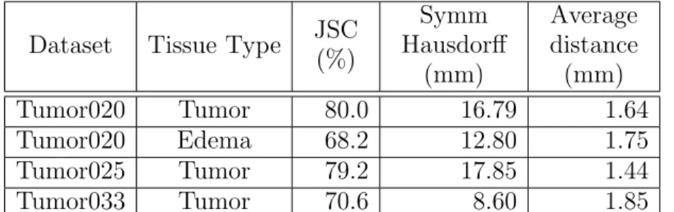 Table 3.3. Validation measures of the automatic tumor segmentation results against the first set of manual segmentation results.