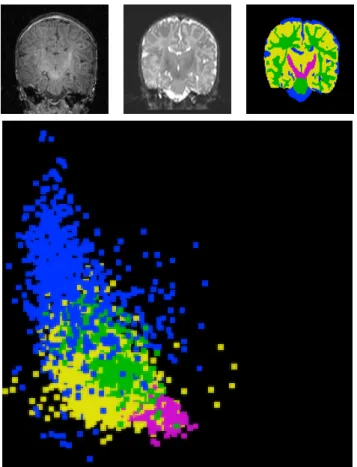 Figure 4.2. Intensity characteristics of one coronal slice of a newborn brain MRI dataset (subject 0096)