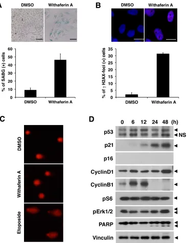 Figure 7: Withaferin A induces cellular senescence and increases p21Cip1 expression in iCSCL-10A cells
