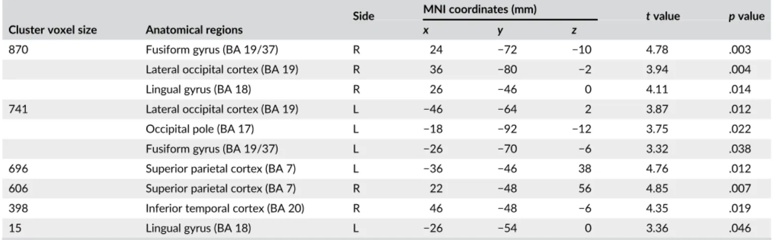 TABLE 3 Cortical thickness in visual cortical regions