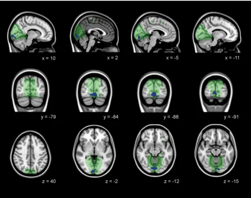 TABLE 5 Decreased functional connectivity in medial visual network in manifest HD