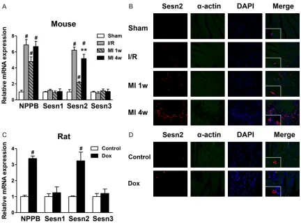 Figure 5. The expression of Sesns in mouse and rat heart failure models. A: The mRNA expression of NPPB and Sesns in mice I/R and MI models