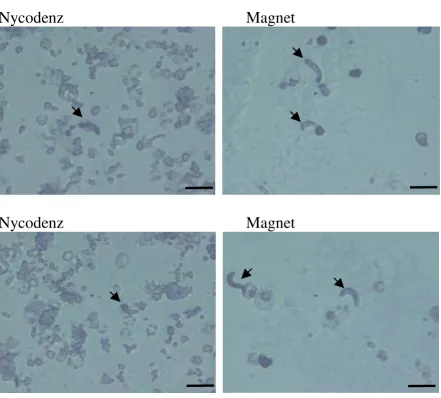 Figure 2Comparison of the degree of red blood cell contamination using two different purification methodsComparison of the degree of red blood cell contamination using two different purification methods