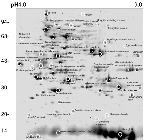 Figure 8Representative 2D gel of parasite proteins from ItG trophozoitesRepresentative 2D gel of parasite proteins from ItG trophozoites