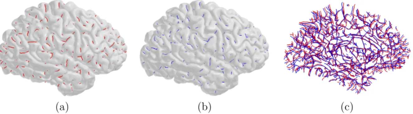 Figure 3.9: Sulcal curve extraction from the different scans for the same subject. (a)-(b) Two sets of curves are labeled with respective colors (red and blue)