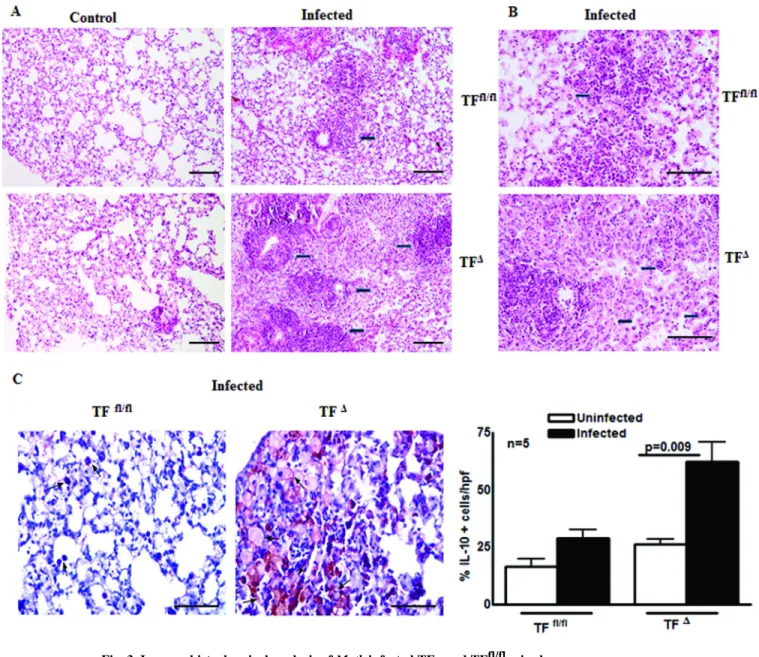 Fig. 3. Immunohistochemical analysis of M. tb infected TF Δ  and TF fl/fl  mice lungs TF Δ  and TF fl/fl  mice were infected with ∼75–100 CFU of M