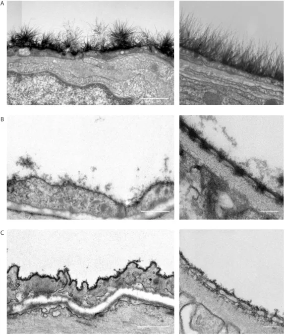 Figure 1:  Three methods to stabilize and stain the endothelial glycocalyx for electron microscopy