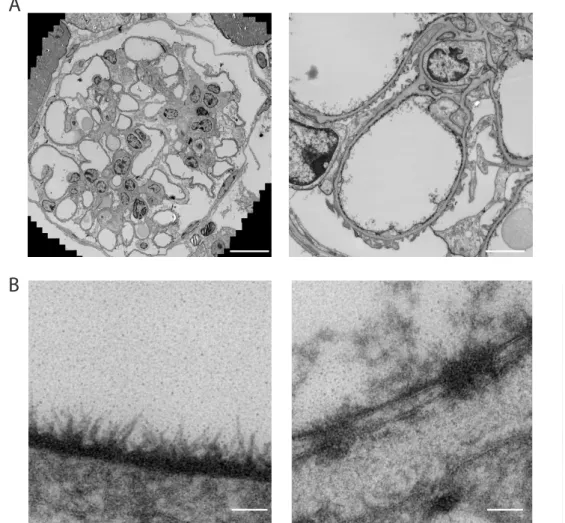 Figure 3: Transmission electron microscopic images of a cupromeronic blue stained glomerulus