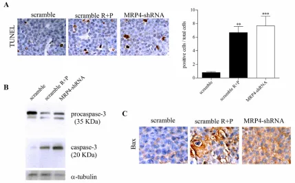 Figure 5: Pro-apoptotic activity of MRP4 knockdown in AML in vivo tumors. (A) Left. Terminal deoxynucleotidyltransferase (TdT)-mediated dUTP digoxigenin nick-end labelling (TUNEL) of scramble, rolipram+probenecid (scramble R+P) and MRP4-shRNA tumors