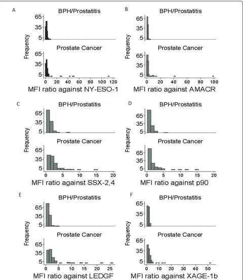 Figure 3 Distribution of autoAb in patients with BPH/prostatitis and prostate cancer.(F) Histograms depicting the frequency or number ofpatients and their specific MFI ratios against NY-ESO-1:1-40 (A), AMACR:341-371 (B), SSX-2,4 (C), p90 autoantigen (D), L