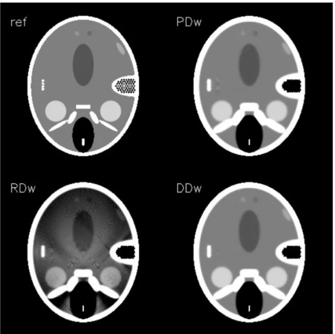 Figure 4-6: FBP reconstruction of a head section: reference image, pixel-driven FBP, normalized  ray-driven FBP, and distance-driven FBP.[115] 