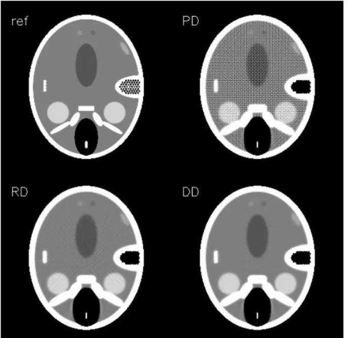 Figure 4-7: Iterative reconstruction of a head section using maximum likelihood (ML) algorithm: 
