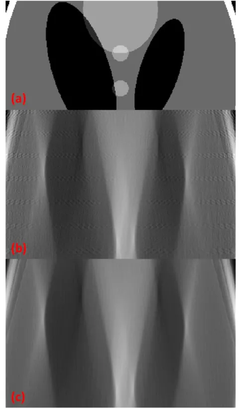 Figure  4-8:  Enlarged  view  of  (a)  a  Shepp-Logan  phantom,  AFVR-SIRT  reconstruction  of  the  Shepp-Logan phantom (b) using ray-driven projection model, and (c) using  the distance-driven  projection model
