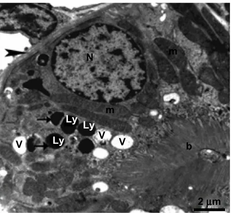 Figure 8 Higher magnification of the previous micrograph showing the nucleus, well developed mitochondria, and membranous vesicles, as well as lysosomes containing electron-dense nanoparticles (thick arrows)