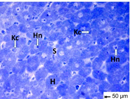 Figure 14 Magnified micrograph of a hepatic cell from the control group showing the normal ultrastructure of the nucleus and its nuclear membrane, containing nucleopores (arrows), well developed rough endoplasmic reticulum, well developed mitochondria, and