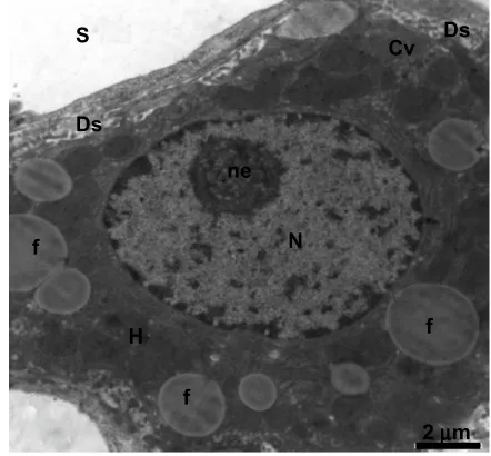 Figure 15 Transmission electron micrograph of a hepatic cell from the treated group containing numerous fat globules and a nucleus with hypertrophied nucleoli