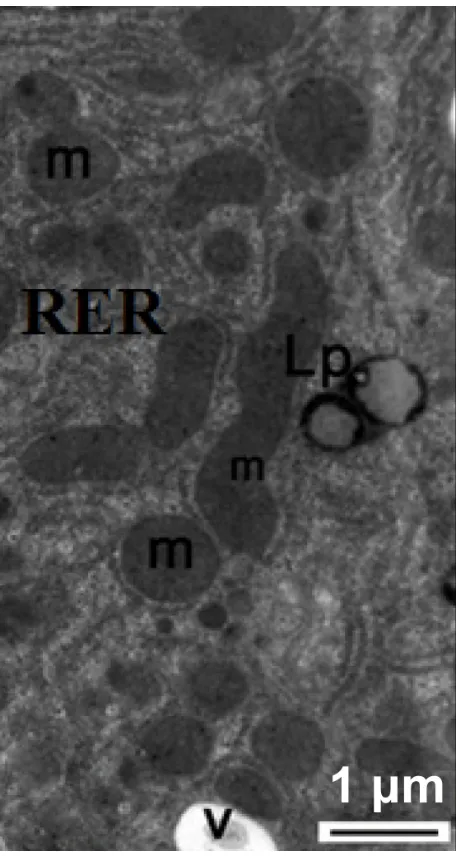 Figure 18 Transmission electron micrograph of a hepatic cell from the treated filled with electron-dense material of silver nanoparticles (arrows) and the group containing numerous fat globules, rough endoplasmic reticulum, and mitochondria