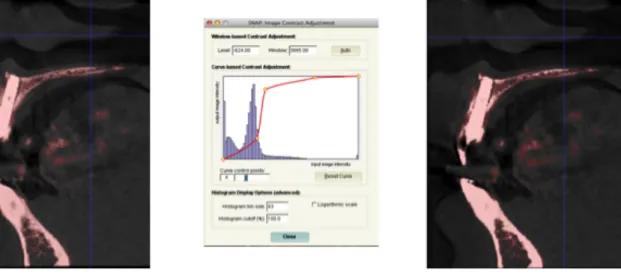 Figure 3.   By adjusting the histogram (figure in the center) subtle differences in density are  more easily observed