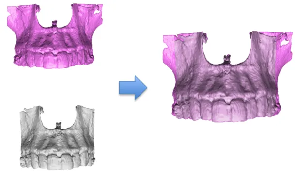 Figure 6.  This represents the process of automatic surface registration via VAM software  (Canfield Scientific)