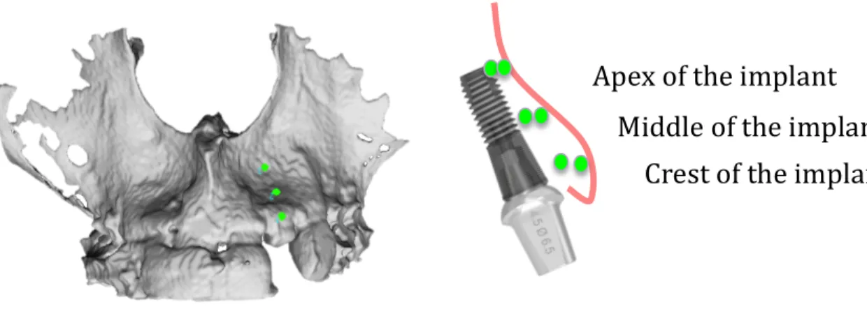 Figure  8.    This  figure  illustrates  the  process  of  landmark  placement  for  measuring  in  the  VAM (Canfield Scientific)