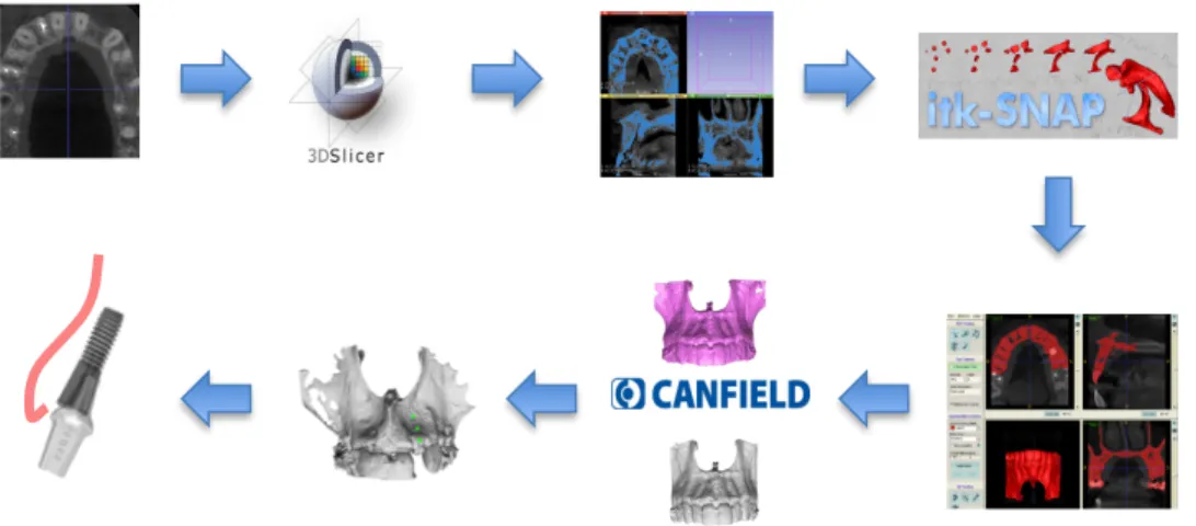Figure 10.  Represents all of the steps required in the workflow of analyzing linear alveolar  changes from DICOM images
