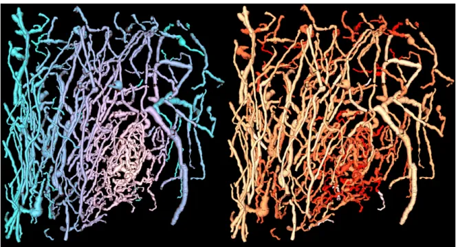 Figure 4.14: Segmented vessels are rendered and displayed in a color-map showing dis- dis-tance from the tumor margin (blue) and sum of angles tortuosity (red).