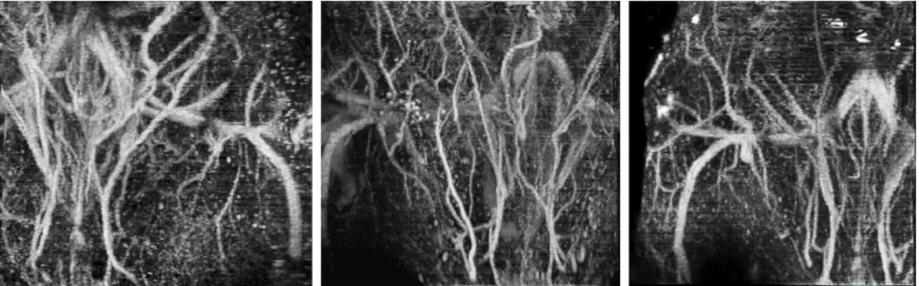 Figure 5.5: Maximum intensity projections of 3 control images, in the coronal plane.