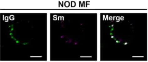 Fig. S1. IgG and Sm staining is punctate on the surface of NOD myeloid cells.  Splenic myeloid  cells (CD11b + ) were purified from NOD mice and analyzed for surface levels of Sm and IgG by  confocal microscopy (Bar=5 μm); 2 experiments, 2 mice, 15-20 cell