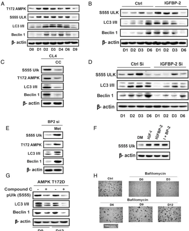 Figure 4. Activation of autophagy at the early stage of differentiation is required for optimal osteoblast differentiation